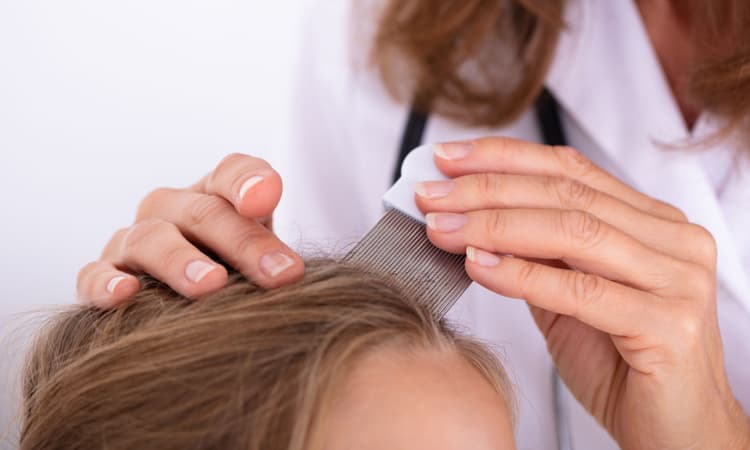 Shortage of specialist shampoo sees lice rapidly infect Swiss schools