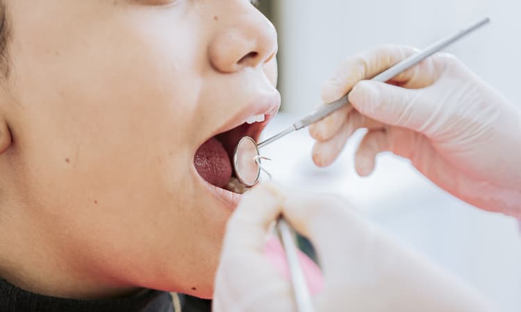 One in five Swiss residents don't visit the dentist due to costs